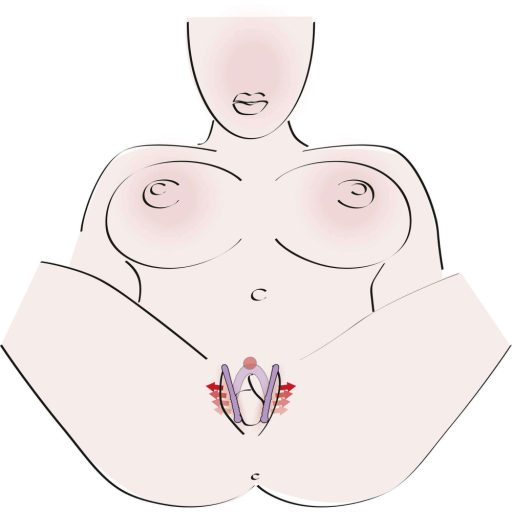 You2Toys - Intimate Spreader hüvely széthúzó