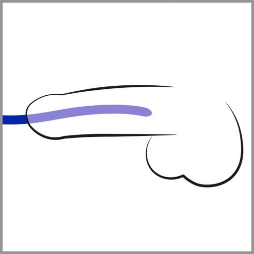 You2Toys - DILATOR - kék szilikon húgycsőtágító dildó szett 3db