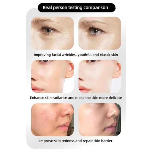 / Photon Rejuvenation Arcápoló LED maszk