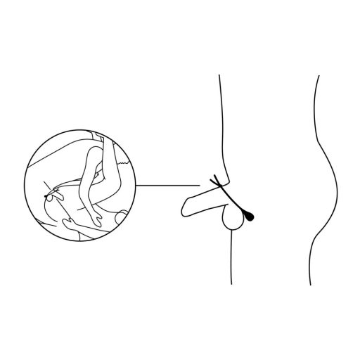 Nexus Forge - állítható vibrációs péniszgyűrű (fekete)